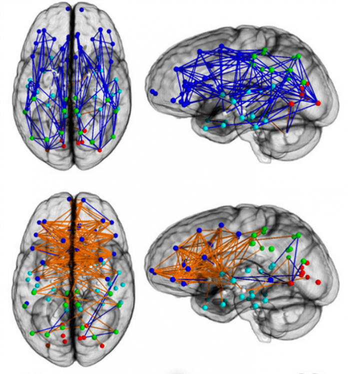 diferencias-sexo-cerebro3