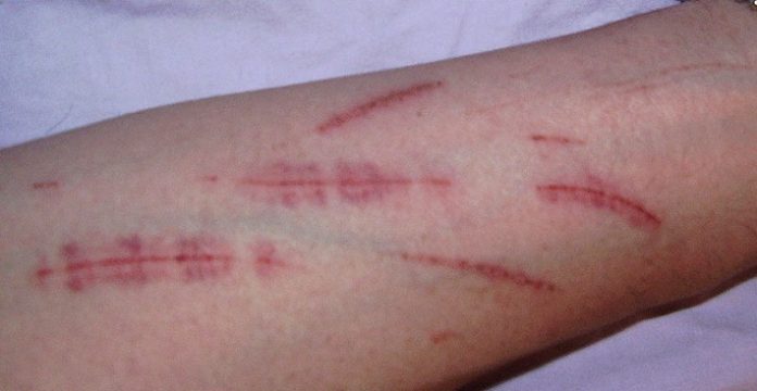 autolesion