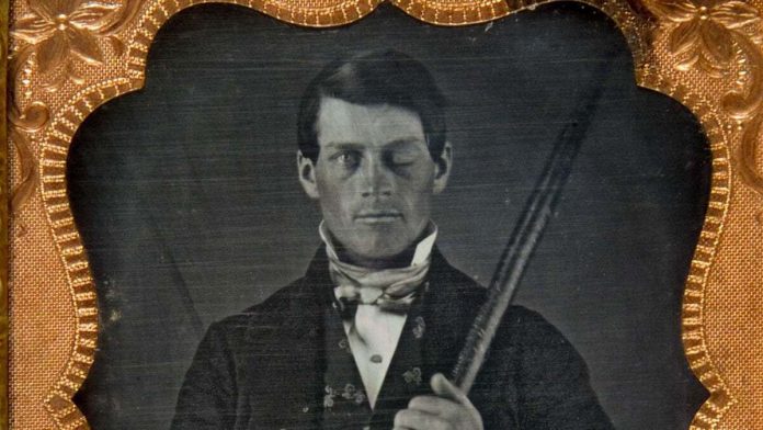 phineasgage Psicología
