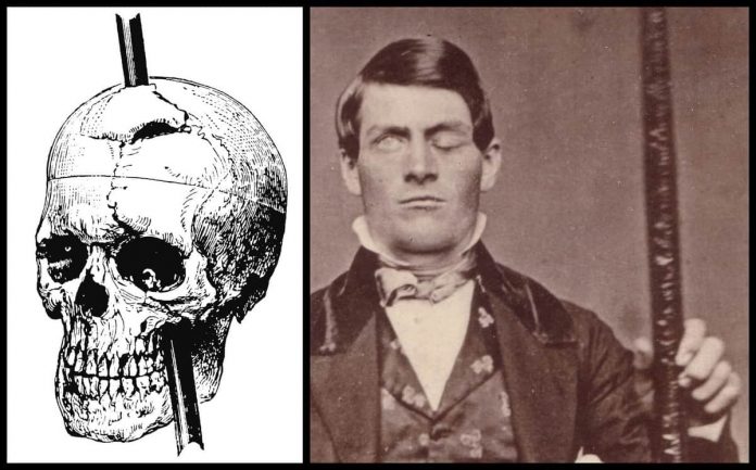 phineas gage cerebro