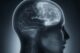 Radiografía de perfil de una cabeza humana en la que se ve el cerebro en tonos azulados