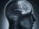 Radiografía de perfil de una cabeza humana en la que se ve el cerebro en tonos azulados