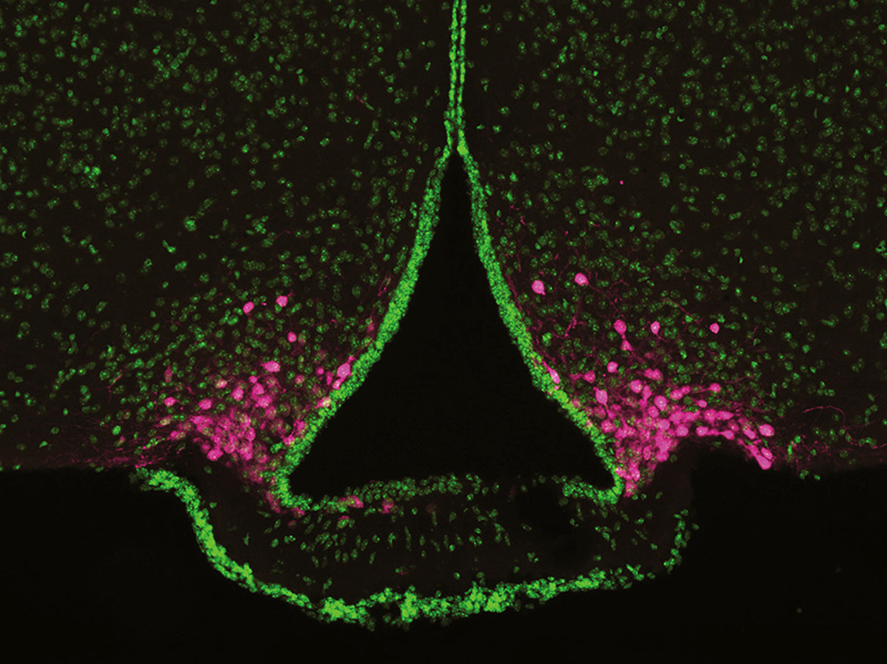 Neuronas hambrientas en el cerebro