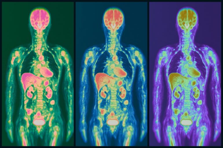 La neurociencia del cuerpo: cuando el cerebro se escucha a sí mismo